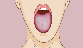 舌苔异样