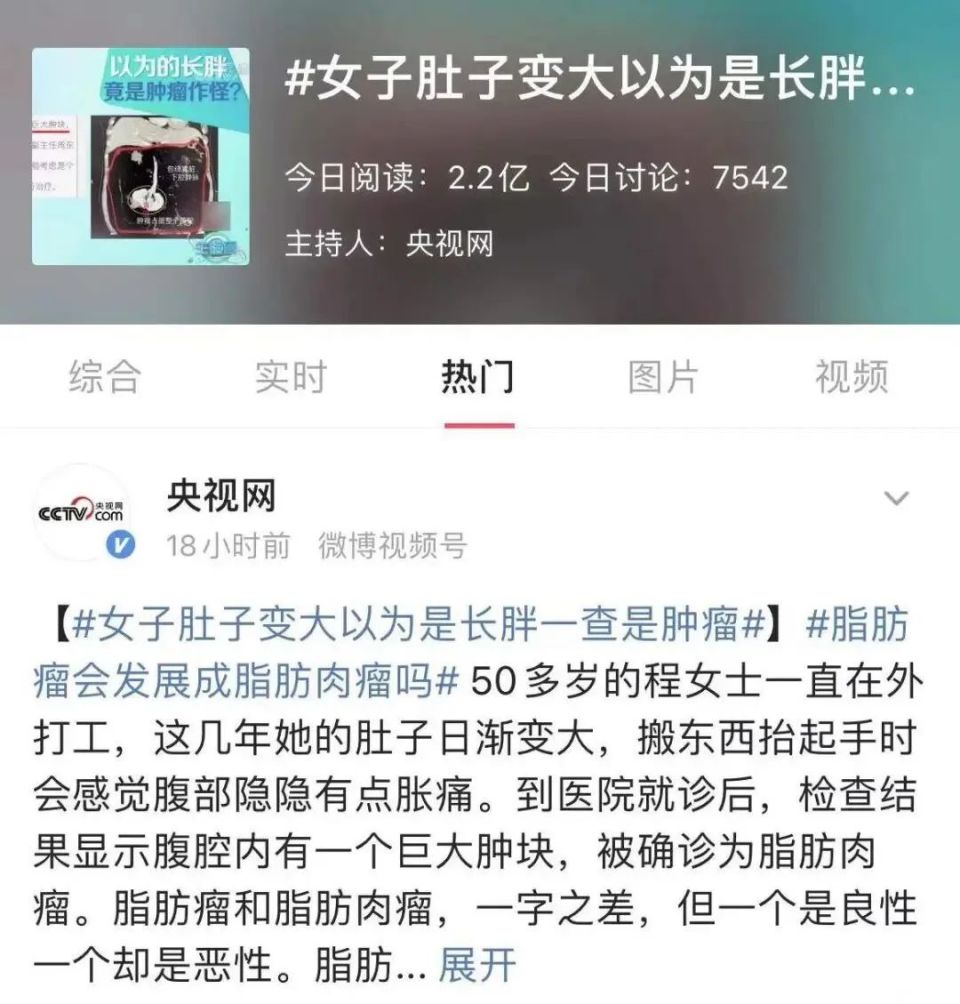 网友案例