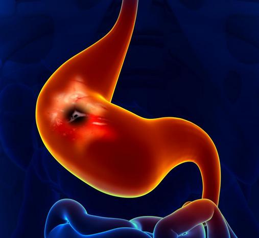 病毒性胃肠炎有什么症状和表现