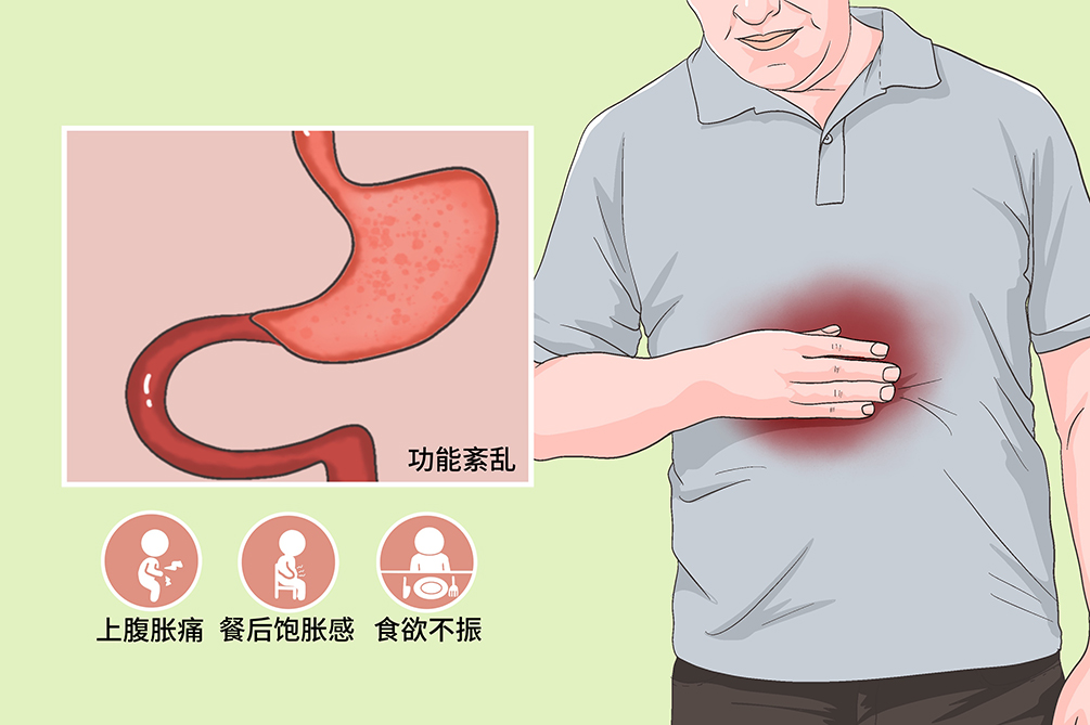 消化不良腹泻是怎么回事?