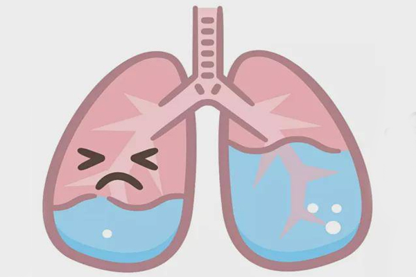 肺水肿原因及治疗方法有心源性肺水肿/药物治疗