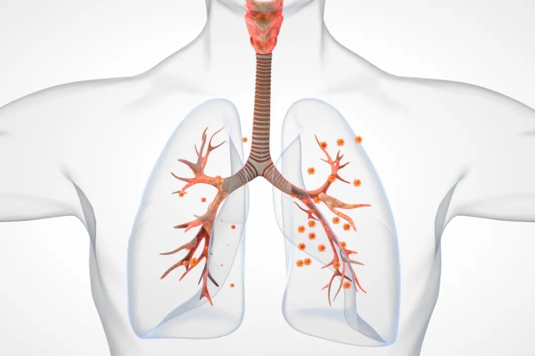 气管炎的症状有哪些，咳嗽/胸闷/呼吸急促/发热