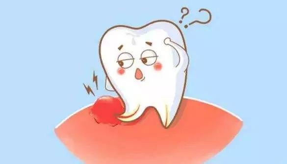 牙龈肿痛消炎药