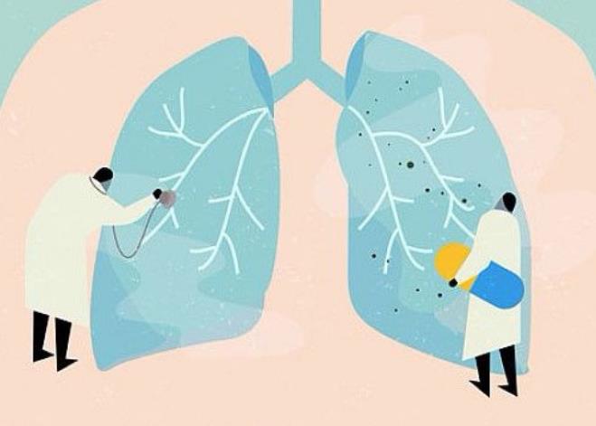 肺栓塞是什么病，六种症状出现要当心