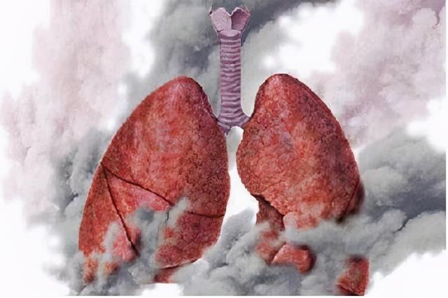 湿肺是什么意思(湿肺的预防和治疗)
