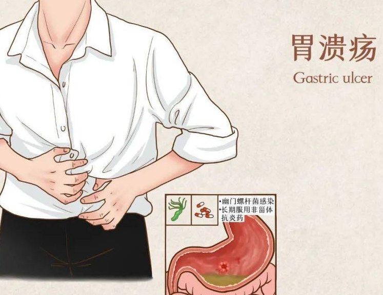 胃溃疡会变成胃癌吗，不适当管理和治疗会增加患癌的风险