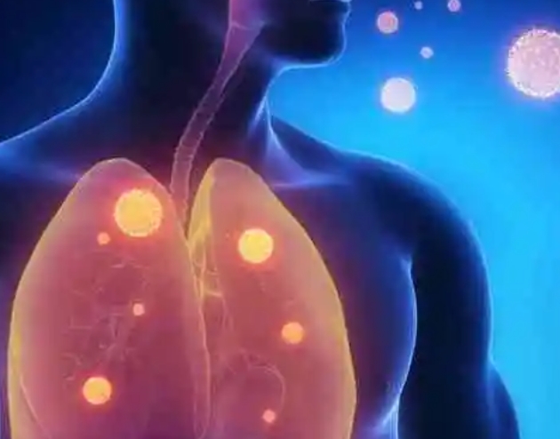 肺水肿的处理措施，5种措施(4种预防方法)