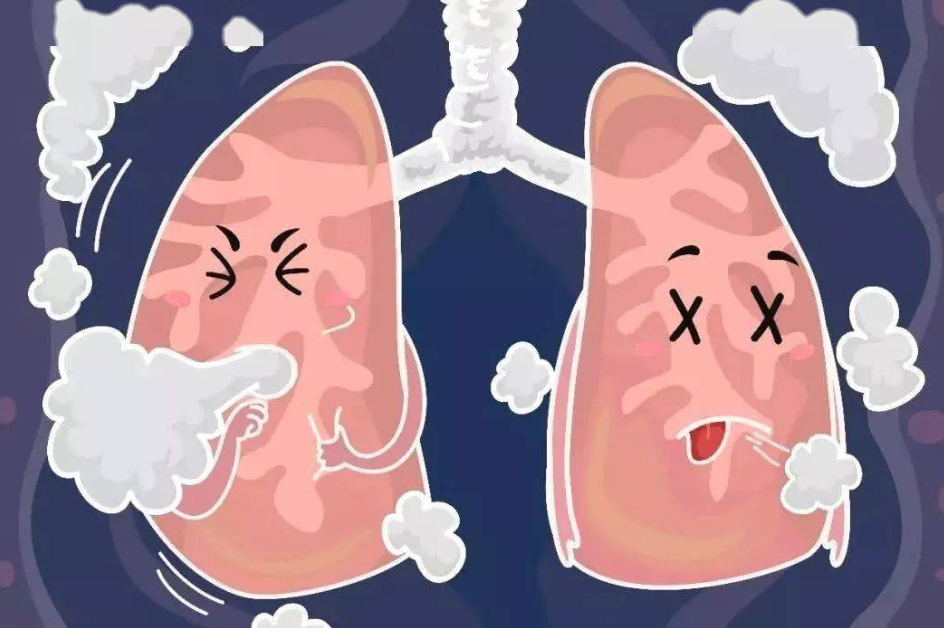 慢阻肺（COPD）吃什么药最有效？五种常用的COPD药物