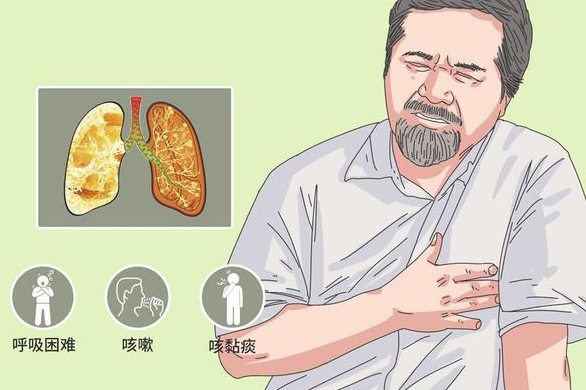 肺部疾病的症状有哪些症状表现，有5种症状(咳嗽/胸痛)