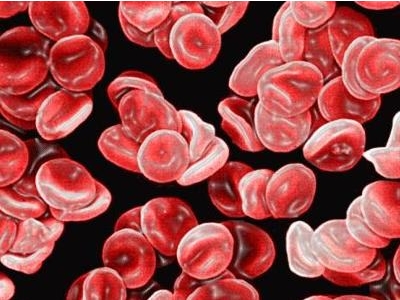 红细胞增多症诊断标准，常见5种诊断标准