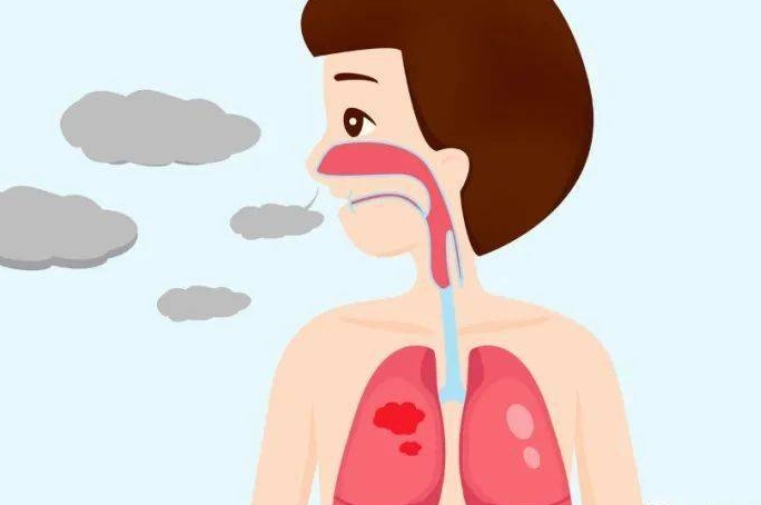 呼吸衰竭的治疗主要在于氧疗和抗感染治疗