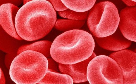 红细胞增多症是绝症吗，不是绝症(属于严重的血液疾病)