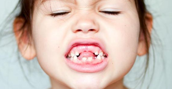 畸形牙齿矫正的最佳年龄，儿童时期进行