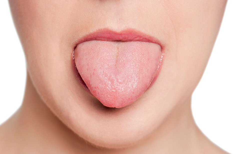 舌苔异常出现什么毛病（ 口腔炎症、贫血，干咳等六种情况）