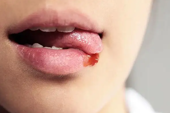 舌苔异样现象时，可能反映出身体存在某些问题