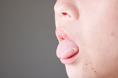 舌苔异味正常吗？正常舌苔应是微微甜味、清淡或无味道