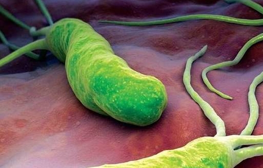 幽门螺旋杆菌阳性是什么病，幽门螺旋杆菌的治疗和预防方法