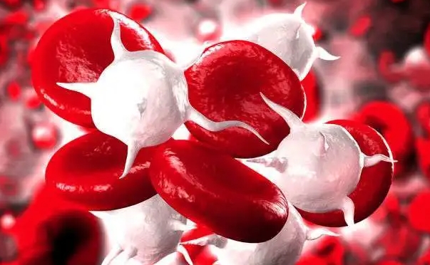 真性红细胞增多症好的治疗方法，放血疗法/药物治疗(4种方法)