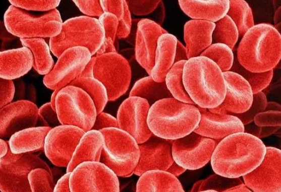 真性红细胞增多症是恶性肿瘤吗，PV的治疗和预后