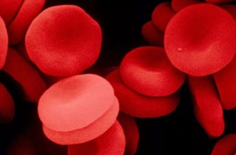 真性红细胞增多症能活多久呢，如何提高PV患者的寿命