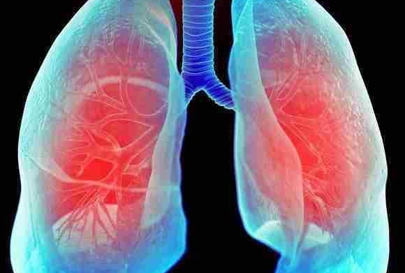 支气管炎会传染吗，如何预防支气管炎的传播
