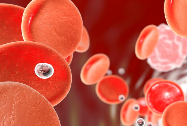 遗传性球形红细胞增多症能治好吗，通过治疗提高患者生活质量