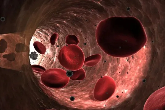 遗传性球形红细胞增多症诊断标准，诊断标准有5种