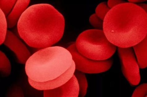 遗传性球形红细胞增多症治疗，脾切除术/药物治疗和输血治疗