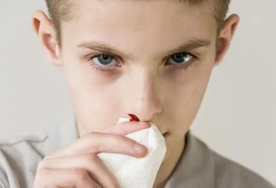 什么是鼻中隔血肿？由于鼻腔黏膜或血管损伤引起的