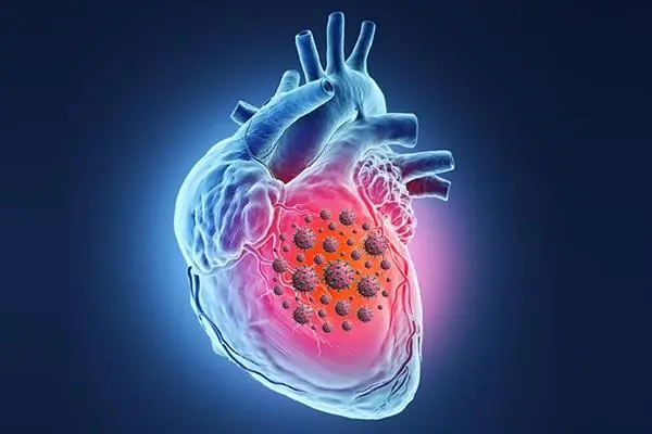 瓣膜病是什么意思，影响心脏功能的疾病