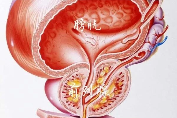 膀胱平滑肌肉瘤影像表现，膀胱镜检、超声检查和CT扫描等