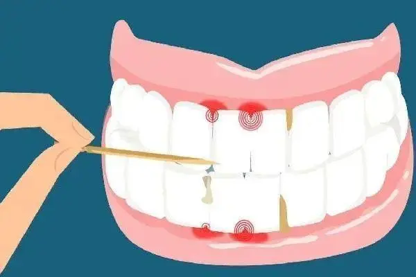 齿突的发育及异常，影响牙齿正常生长发育以及口腔健康