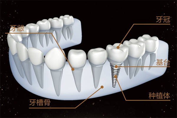 齿状突发育畸形怎么治疗，正畸矫正、牙齿拔除等