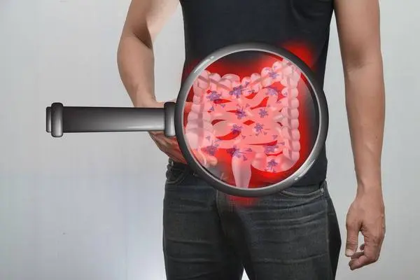 大肠息肉的症状，大便血便、腹痛和腹胀等五种症状