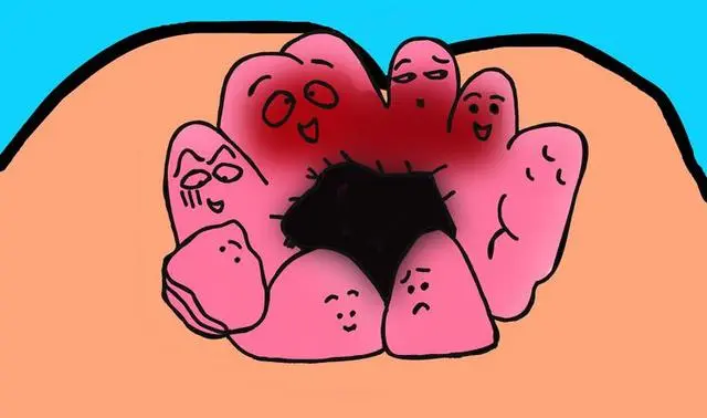 肛门瘙痒症是怎么回事，四种常见原因