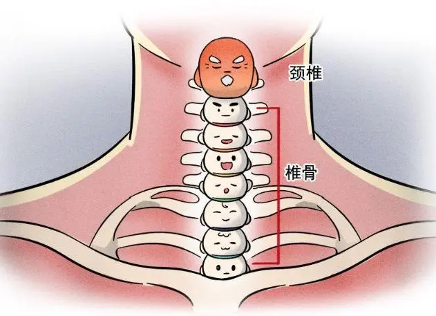 治疗寰枢椎不对称的注意事项