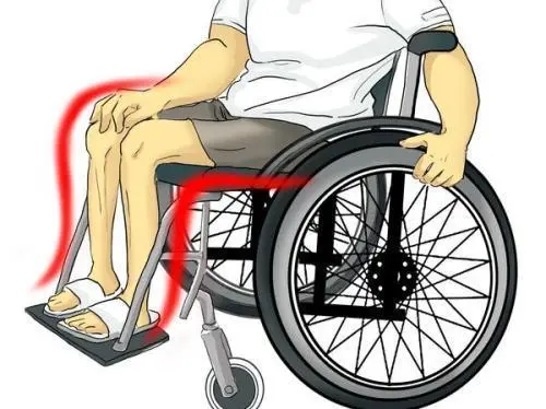 脊髓损伤导致下肢瘫痪能治疗好吗，难以完全治好的疾病
