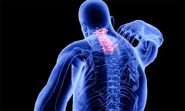 脊髓血管畸形是什么原因导致的？