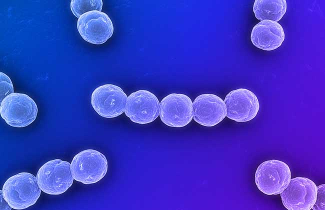 链球菌感染是什么病？由链球菌引起的传染病