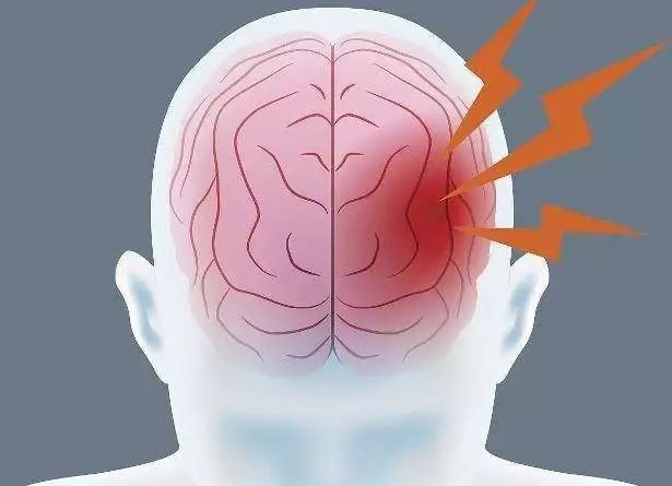 颅脑创伤是什么意思，头部受到外力作用导致的脑部损伤