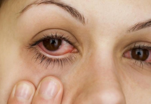 角膜溃疡视力模糊，角膜溃疡的诊断和治疗