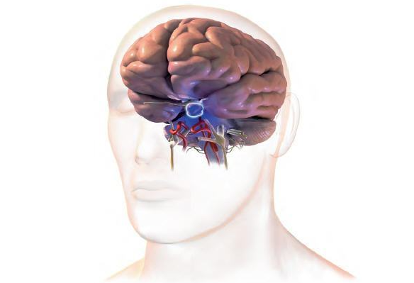 脑垂体瘤严重吗？