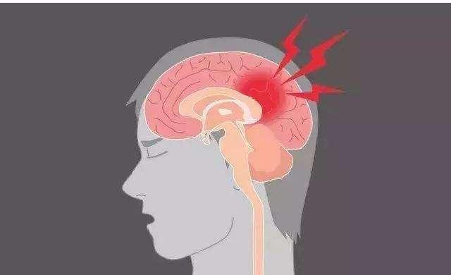 脑损伤病人中间清醒期提示