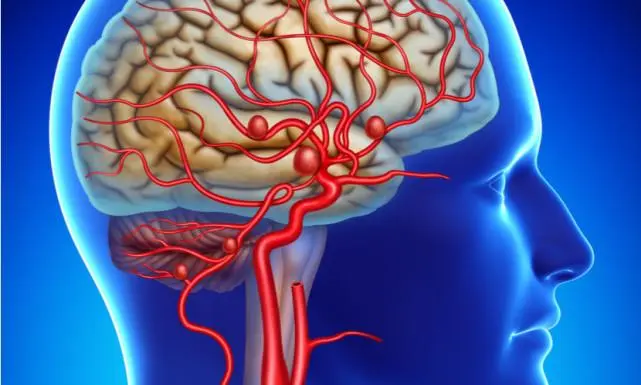 脑血管痉挛有哪些症状，意识改变/步态不稳和肢体无力等