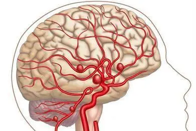 脑血管瘤是什么原因，血管发育异常/血管损伤和遗传等