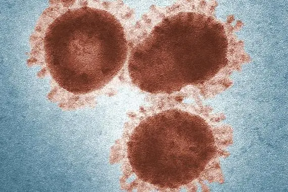 柯萨奇病毒感染是怎么回事，柯萨奇病毒的传播途径