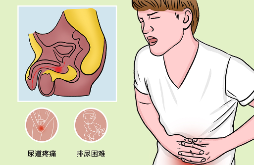 尿道外伤出血能自愈吗，多数情况下会自行停止