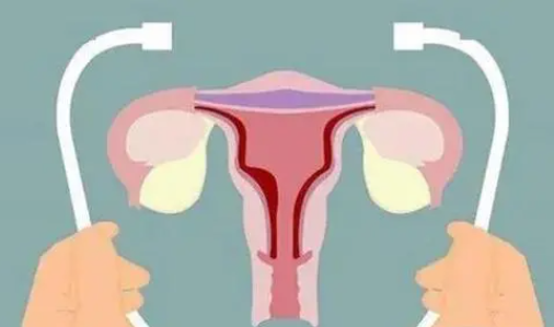 女性尿道肿瘤有哪些症状