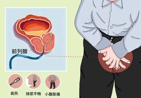 前列腺炎有什么症状，排尿困难/肛门不适和性功能障碍等