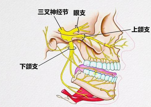 三叉神经瘤怎么治疗较好